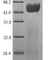 Zaire ebolavirus Envelope glycoprotein (GP), partial Recombinant Protein, N-His, Extracellular Domain - BioCrest Sci