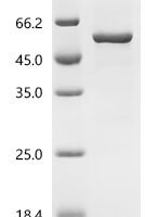 Human protein-tyrosine-phosphatase (PTPRR) Recombinant Protein, C-His - BioCrest Sci