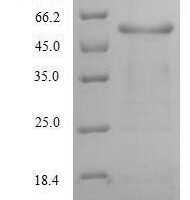 Human Alanine aminotransferase 1 (GPT) Recombinant Protein, N-His - BioCrest Sci