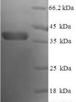 Human Bcl-2-like protein 1 (BCL2L1), partial Recombinant Protein - BioCrest Sci