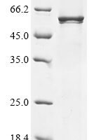 Human Kynurenine 3-monooxygenase (KMO) Recombinant Protein, N-His, aa 1–486, E.coli - BioCrest Sci