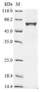 Human Kynurenine 3-monooxygenase (KMO) Recombinant Protein, N-His, aa 1–486, E.coli, Homo sapiens (Human), E.coli, N-terminal 6xHis-tagged, 61.8 kDa, purity >≥ 85% as determined by SDS-PAGE.
