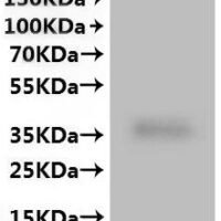 Human Ileal sodium/bile acid cotransporter (SLC10A2)-VLPs Recombinant Protein - BioCrest Sci