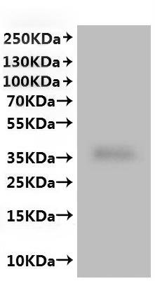 Human Ileal sodium/bile acid cotransporter (SLC10A2)-VLPs Recombinant Protein, Homo sapiens (Human), Mammalian cell, C-terminal 10xHis-tagged, 39.1 kDa, purity >VLPs