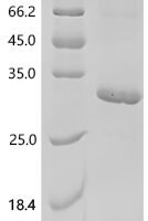 Oncorhynchus mykiss Somatotropin-1 (gh1) Recombinant Protein - BioCrest Sci