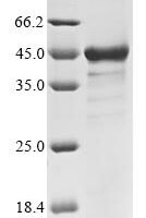 Human Lymphokine-activated killer T-cell-originated protein kinase (PBK) Recombinant Protein - BioCrest Sci
