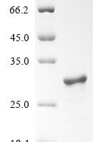 Pig Ubiquitin carboxyl-terminal hydrolase isozyme L1 (UCHL1), partial Recombinant Protein - BioCrest Sci