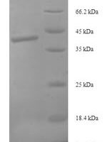 Human Syntaxin-10 (STX10), partial Recombinant Protein - BioCrest Sci