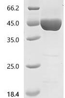 Mouse Advanced glycosylation end product-specific receptor (Ager), partial Recombinant Protein - BioCrest Sci