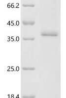 Human Cyclin-dependent kinase 12 (CDK12), partial Recombinant Protein, N-GST - BioCrest Sci