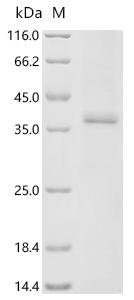Human Cyclin-dependent kinase 12 (CDK12), partial Recombinant Protein, N-GST, Homo sapiens (Human), Homo sapiens (Human), N-terminal GST-tagged, 64 kDa, purity >≥ 85% as determined by SDS-PAGE.