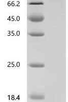 Human Heat shock protein HSP 90-alpha (HSP90AA1), Biotinylated Recombinant Protein - BioCrest Sci