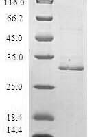 Human Defensin beta 4A (DEFB4A) Recombinant Protein - BioCrest Sci