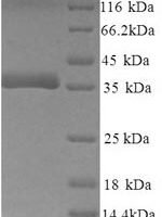 Mouse Decorin (Dcn), partial Recombinant Protein, N-His, aa 35–354, Yeast - BioCrest Sci