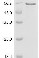 Rat Sialate O-acetylesterase (Siae) Recombinant Protein - BioCrest Sci