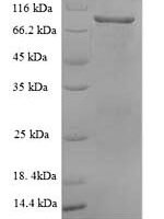 Rat Vascular cell adhesion protein 1 (Vcam1), partial Recombinant Protein - BioCrest Sci