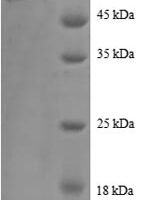 Human Annexin A2 (ANXA2) Recombinant Protein, N-GST - BioCrest Sci