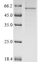 Human Leucine-rich glioma-inactivated protein 1 (LGI1) Recombinant Protein, N-His-PDI - BioCrest Sci