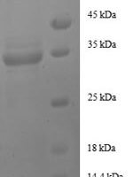 Rat Insulin-like growth factor I (Igf1) Recombinant Protein - BioCrest Sci