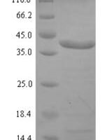 Spiroplasma citri Spiralin (spi) Recombinant Protein - BioCrest Sci