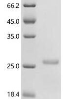 Horse Lutropin/choriogonadotropin subunit beta (LHB) Recombinant Protein - BioCrest Sci