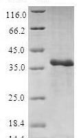Human 40S ribosomal protein S27 (RPS27) Recombinant Protein - BioCrest Sci