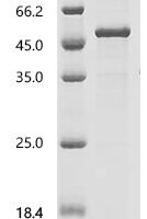 Human Endogenous retrovirus group K member 25 Env polyprotein (ERVK-25), partial Recombinant Protein - BioCrest Sci