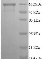 Human Eukaryotic translation initiation factor 5 (EIF5) Recombinant Protein - BioCrest Sci