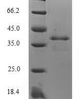 Mouse Protein S100-A8 (S100a8) Recombinant Protein - BioCrest Sci