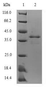 Mouse Protein S100-A8 (S100a8) Recombinant Protein, Mus musculus (Mouse), E.coli, N-terminal GST-tagged, 37.2 kDa, purity >≥ 90% as determined by SDS-PAGE.