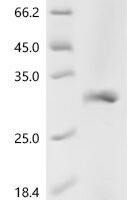 Human Trypsin-2 (PRSS2) Recombinant Protein - BioCrest Sci