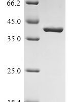 Lake Victoria marburgvirus Transcriptional activator VP30 (VP30) Recombinant Protein - BioCrest Sci