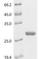 Staphylococcus epidermidis Glutamyl endopeptidase (gseA) Recombinant Protein - BioCrest Sci