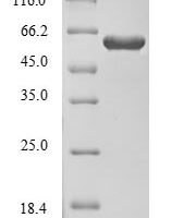 Human Dihydropyrimidinase-related protein 1 (CRMP1) Recombinant Protein, Tag-Free - BioCrest Sci