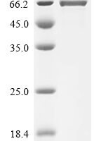Human Desmoglein-1 (DSG1), partial Recombinant Protein, C-10His, aa 24–548 - BioCrest Sci