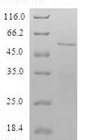 Human Spindlin-1 (SPIN1) Recombinant Protein - BioCrest Sci
