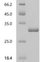 Mouse COMM domain-containing protein 9 (Commd9) Recombinant Protein - BioCrest Sci