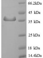 Human Sperm mitochondrial-associated cysteine-rich protein (SMCP) Recombinant Protein - BioCrest Sci