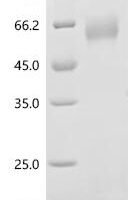 Porcine reproductive and respiratory syndrome virus Glycoprotein 4（GP4), partial Recombinant Protein - BioCrest Sci
