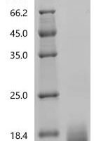 Human Seizure protein 6 homolog (SEZ6), partial Recombinant Protein, C-10His, aa 355–414, Mammalian cell - BioCrest Sci