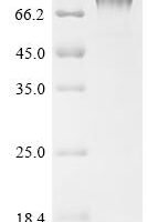 Human metapneumovirus Major surface glycoprotein G (G), partial Recombinant Protein, C-hFc1 - BioCrest Sci