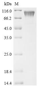 Human metapneumovirus Major surface glycoprotein G (G), partial Recombinant Protein, C-hFc1, Human metapneumovirus (strain CAN97-83) (HMPV), Mammalian cell, C-terminal hFc1-tagged, 47.0 kDa, purity >≥ 95% as determined by SDS-PAGE.