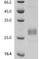 Human Interleukin-33 (IL33), partial Recombinant Protein, N-10His - BioCrest Sci