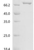 Escherichia coli Colicin-Ia (cia) Recombinant Protein, C-His - BioCrest Sci