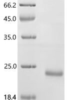 Mouse Sushi, von Willebrand factor type A, EGF and pentraxin domain-containing protein 1 (Svep1), partial Recombinant Protein, C-His, aa 2140–2260, E.coli - BioCrest Sci