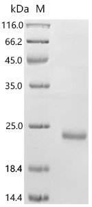 Mouse Sushi, von Willebrand factor type A, EGF and pentraxin domain-containing protein 1 (Svep1), partial Recombinant Protein, C-His, aa 2140–2260, E.coli, Mus musculus (Mouse), E.coli, C-terminal 6xHis-tagged, 20.0 kDa, purity >≥ 85% as determined by SDS-PAGE.