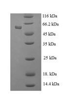 Human Histone-binding protein RBBP7 (RBBP7) Recombinant Protein - BioCrest Sci