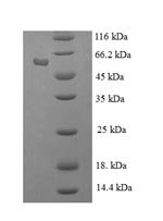 Human Histone-binding protein RBBP7 (RBBP7) Recombinant Protein, Homo sapiens (Human), E.coli, N-terminal 6xHis-SUMO-tagged, 63.8 kDa, purity >≥ 90% as determined by SDS-PAGE.