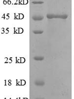 Human Matrilysin (MMP7) Recombinant Protein - BioCrest Sci