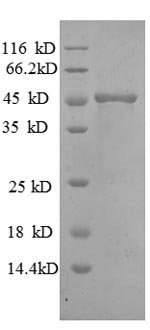 Human Matrilysin (MMP7) Recombinant Protein, Homo sapiens (Human), E.coli, N-terminal GST-tagged, 46.1 kDa, purity >≥ 90% as determined by SDS-PAGE.
